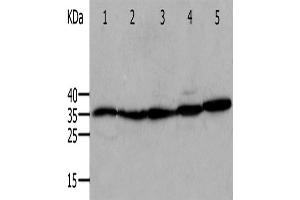 Western Blotting (WB) image for anti-Annexin A5 (ANXA5) antibody (ABIN2420983) (Annexin V antibody)