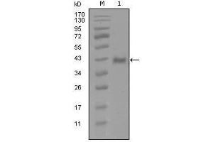 Western Blot showing AR antibody used against truncated Trx-AR recombinant protein (1). (Androgen Receptor antibody  (AA 689-919))