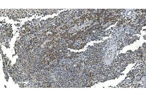 IHC analysis of TIMM8A/DDP using anti-TIMM8A/DDP antibody (ABIN7600039).