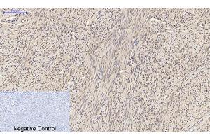 Immunohistochemical analysis of paraffin-embedded human uterus tissue. (SMAD2 antibody)