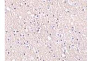 Immunohistochemistry of CIDE-A in human brain tissue with CIDE-A antibody at 5 μg/ml. (CIDEA antibody  (C-Term))