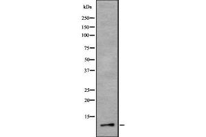 Western blot analysis of RETN using Jurkat whole cell lysates (Resistin antibody  (Internal Region))