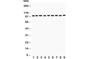 Western blot testing of CBL antibody (0. (CBL antibody  (AA 556-906))