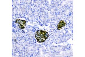 IHC analysis of Nephrin using anti-Nephrin antibody (ABIN5518783).