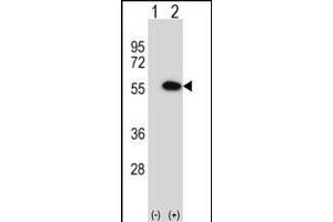 Western blot analysis of MINA (arrow) using rabbit polyclonal MINA Antibody (N-term) (ABIN656399 and ABIN2845694).