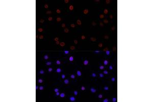 Immunofluorescence (IF) image for anti-Sad1 and UNC84 Domain Containing 2 (SUN2) antibody (ABIN7270136)