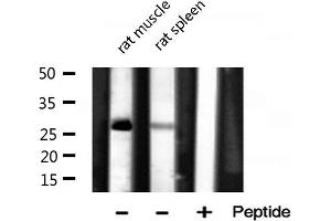 Western blot analysis of MRPL16 expression in various lysates (MRPL16 antibody  (Internal Region))