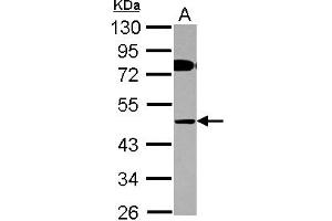 Western Blotting (WB) image for anti-AChE Q Subunit (COLQ) (AA 248-455) antibody (ABIN1497560)