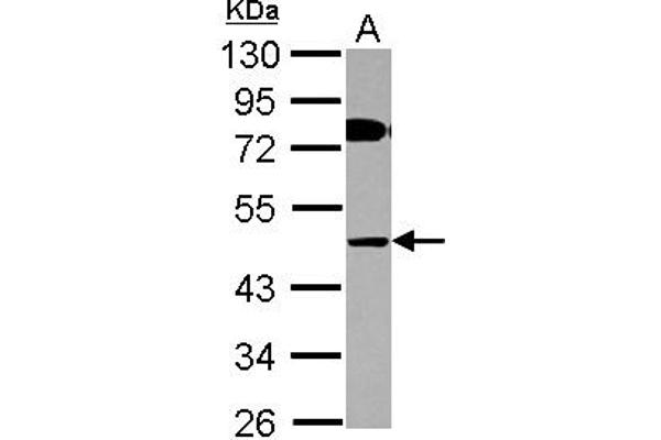 COLQ 抗体  (AA 248-455)