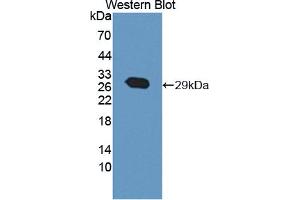Figure. (ABCA12 antibody  (AA 1346-1577))