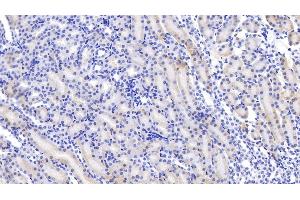 Detection of ABP1 in Mouse Kidney Tissue using Polyclonal Antibody to Amiloride Binding Protein 1 (ABP1) (DAO antibody  (AA 292-460))
