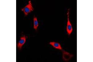 Immunofluorescent analysis of ROCK1 staining in NIH3T3 cells. (ROCK1 antibody  (Center))