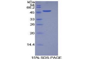 SDS-PAGE (SDS) image for Integrin, alpha 5 (ITGA5) (AA 895-1049) protein (His tag,GST tag) (ABIN2123031)
