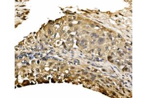 IHC analysis of ADRM1/ARM-1 using anti-ADRM1/ARM-1 antibody (ABIN7600108).