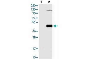 Western blot analysis of Lane 1: Negative control (vector only transfected HEK293T lysate), Lane 2: Over-expression Lysate (Co-expressed with a C-terminal myc-DDK tag (~3. (NSUN3 antibody)