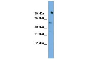 WB Suggested Anti-SLC25A25 Antibody Titration:  0.
