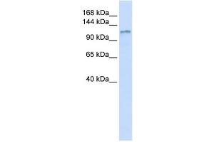DGKH antibody used at 1 ug/ml to detect target protein. (DGKH antibody  (Middle Region))