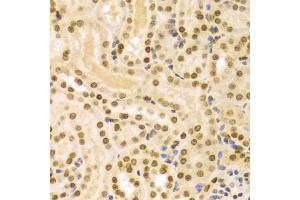 Immunohistochemistry of paraffin-embedded mouse kidney using DKC1 Antibody (ABIN5970956) at dilution of 1/100 (40x lens). (DKC1 antibody)