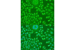 Immunofluorescence analysis of U2OS cells using CCND2 antibody (ABIN1875413) at dilution of 1:100. (Cyclin D2 antibody)