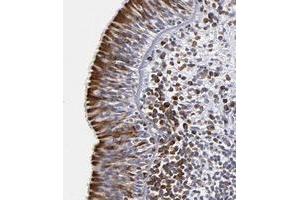 Immunohistochemical staining of human nasopharynx with CEP97 polyclonal antibody  shows strong cytoplasmic positivity in respiratory epithelial cells at 1:200-1:500 dilution.