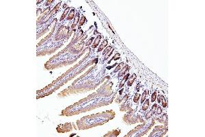 IHC analysis of EIF4A using anti-EIF4A antibody (ABIN7601309). (EIF4A1 antibody  (AA 32-406))