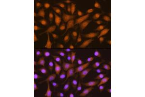 Immunofluorescence analysis of L929 cells using SKP2 Rabbit pAb (ABIN6134430, ABIN6147822, ABIN6147824 and ABIN6223665) at dilution of 1:100. (SKP2 antibody  (AA 1-100))