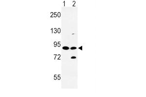 Western Blotting (WB) image for anti-Solute Carrier Family 8 (Sodium/calcium Exchanger), Member 1 (SLC8A1) antibody (ABIN3003974) (SLC8A1 antibody)
