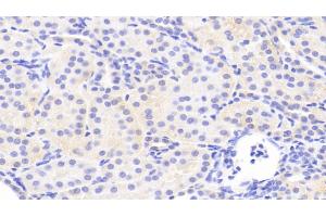 Detection of JNK1 in Human Kidney Tissue using Polyclonal Antibody to c-Jun N-terminal Kinase 1 (JNK1) (C-Jun N-Terminal Kinases (AA 145-419) antibody)