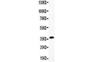 Anti-Myeloperoxidase Picoband antibody,  All lanes: Anti- Myeloperoxidase at 0. (Myeloperoxidase antibody  (AA 406-745))