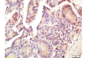 Formalin-fixed and paraffin embedded mouse intestine labeled with Rabbit Anti Smac/DIABLO Polyclonal Antibody, Unconjugated (ABIN674619) at 1:200 followed by conjugation to the secondary antibody and DAB staining