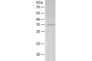 Western Blotting (WB) image for Mitochondrial rRNA Methyltransferase 1 Homolog (MRM1) (AA 21-353) protein (His tag) (ABIN7287628) (MRM1 Protein (AA 21-353) (His tag))