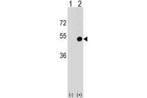 Western blot analysis of CD1d antibody and 293 cell lysate (2 ug/lane) either nontransfected (Lane 1) or transiently transfected (2) with the CD1D gene. (CD1d antibody  (AA 177-206))