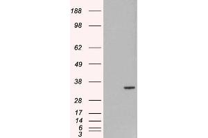 HEK293 overexpressing ORC6L (ABIN5453564) and probed with  (mock transfection in first lane). (ORC6 antibody  (C-Term))