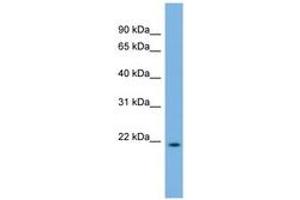 Image no. 1 for anti-DCMP Deaminase (DCTD) (C-Term) antibody (ABIN6743596) (DCMP Deaminase (DCTD) (C-Term) antibody)