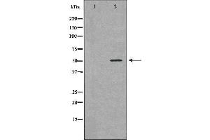 Western blot analysis of Jurkat  lysate using BCL2L13 antibody. (BCL2L13 antibody  (Internal Region))