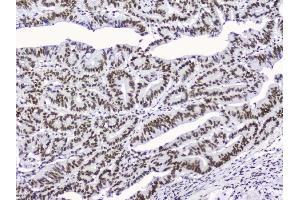 IHC analysis of nmt55/p54nrb using anti-nmt55/p54nrb antibody (ABIN3044530). (NONO antibody  (N-Term))