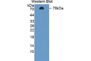 Western blot analysis of the recombinant protein. (FDPS antibody  (AA 1-419))