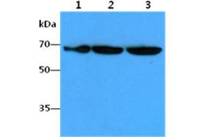 The Cell lysates (40ug) were resolved by SDS-PAGE, transferred to PVDF membrane and probed with anti-human FUBP1 antibody (1:1000). (FUBP1 antibody)