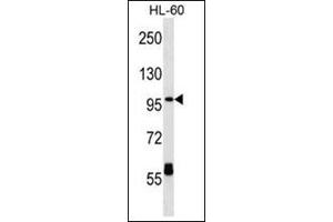Western blot analysis of CPT1C Antibody (C-term) Cat. (CPT1C antibody  (C-Term))