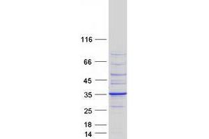 Western Blotting (WB) image for Breast Cancer Metastasis Suppressor 1 (BRMS1) (Transcript Variant 1) protein (Myc-DYKDDDDK Tag) (ABIN2715333)