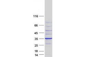 Validation with Western Blot (BRMS1 Protein (Transcript Variant 1) (Myc-DYKDDDDK Tag))