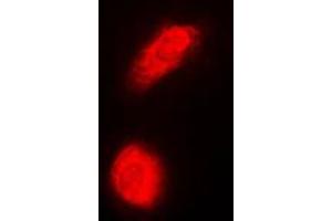 Immunofluorescent analysis of DAXX staining in HeLa cells. (DAXX antibody  (Center))