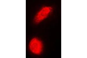 Immunofluorescent analysis of DAXX staining in HeLa cells.