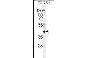 PYGO1 Antibody (C-term) (ABIN656121 and ABIN2845460) western blot analysis in ZR-75-1 cell line lysates (35 μg/lane). (PYGO1 antibody  (C-Term))