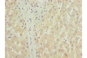Immunohistochemistry of paraffin-embedded human liver tissue using ABIN7149150 at dilution of 1:100 (COX17 antibody  (AA 1-63))