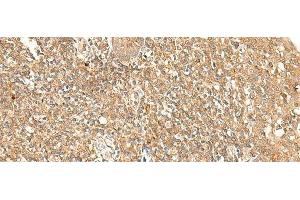 Immunohistochemistry of paraffin-embedded Human tonsil tissue using GPR89A/GPR89B Polyclonal Antibody at dilution of 1:25(x200) (GPR89A antibody)