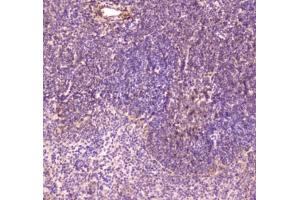 IHC testing of FFPE mouse spleen tissue with CD163 antibody at 1ug/ml. (CD163 antibody)