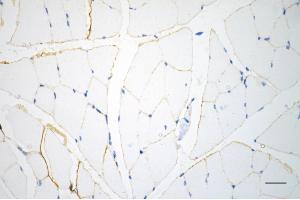 Immunohistochemistry was performed on paraffin-embedded mouse skeletal muscle using caveolin 3 antibody (ABIN7797947), 1:200). (Recombinant Caveolin 3 antibody)