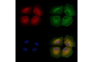ABIN6258498 and ABIN6274470 staining  cells by IF/ICC.