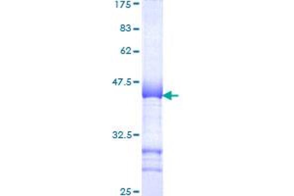 SMARCC1 Protein (AA 338-437) (GST tag)
